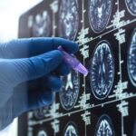 Wyzwania w implementacji systemów machine learning w diagnostyce