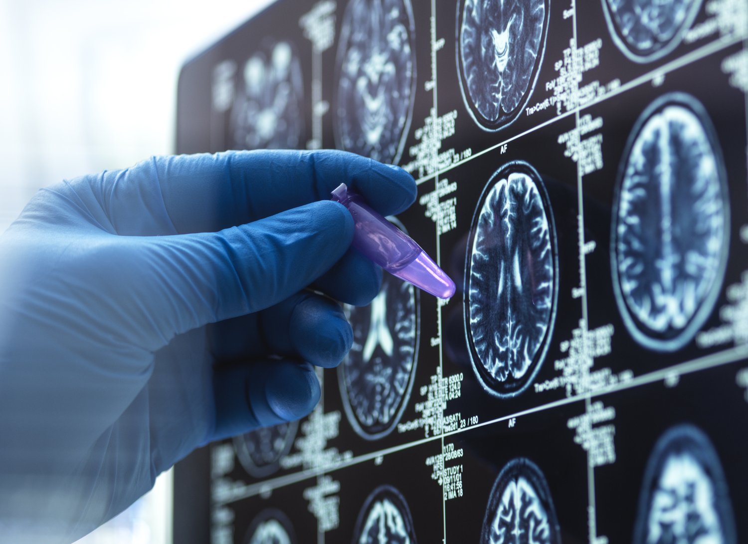 Wyzwania w implementacji systemów machine learning w diagnostyce